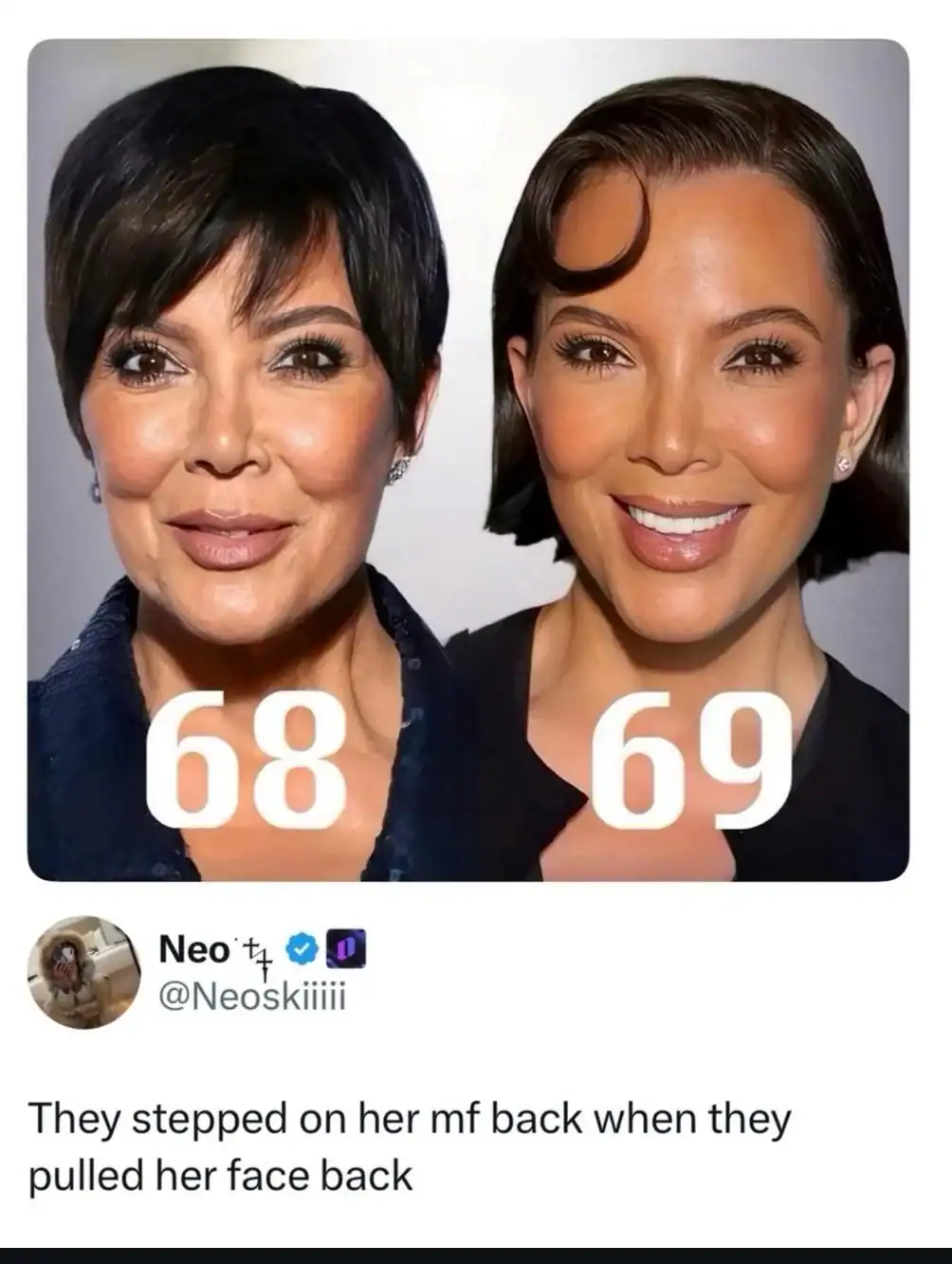 Comparison photo of Kris Jenner and Kim Kardashian with a roast about extreme face-pulling plastic surgery.