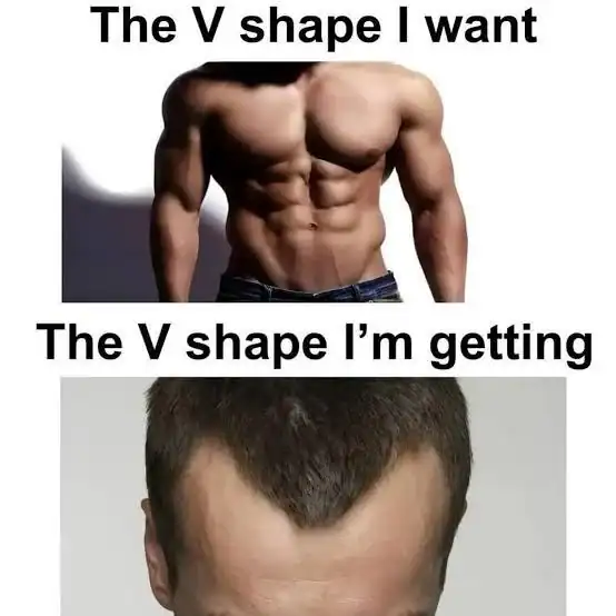 A funny gym meme contrasting the shredded abdominal V-shape every lifter wants with the painful reality of the V-shape they are actually getting, which is just a receding hairline, making for a brutal workout meme.