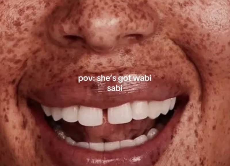 Cheerful smile featuring a prominent tooth gap and freckles representing beautiful wabi sabi features.