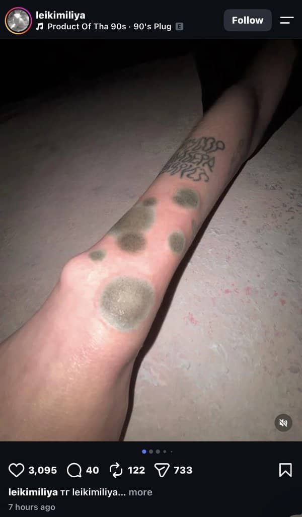 Leg with tattoos designed to look like patches of fuzzy gray mold growing on skin