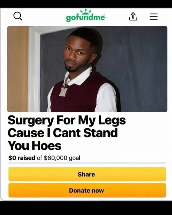 Fake GoFundMe page asking for leg surgery as a setup for a rude pun