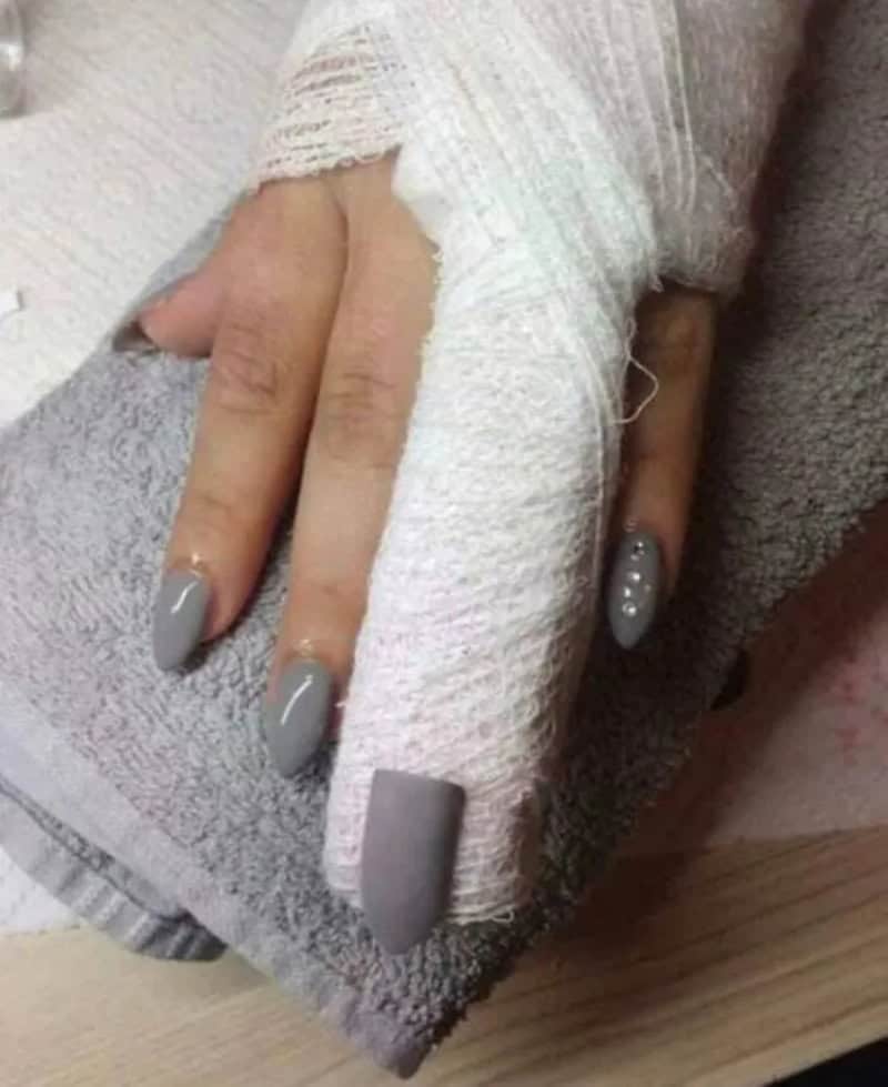 Bandaged finger with a fake nail attached to the tip so the manicure stays complete.