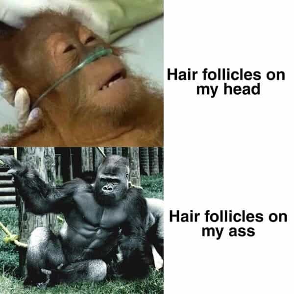 Hair follicles on my head Hair follicles on my ass