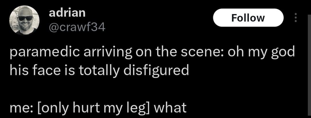 adrian Follow @crawf34 paramedic arriving on the scene: oh my god his face is totally disfigured me: [only hurt my leg] what