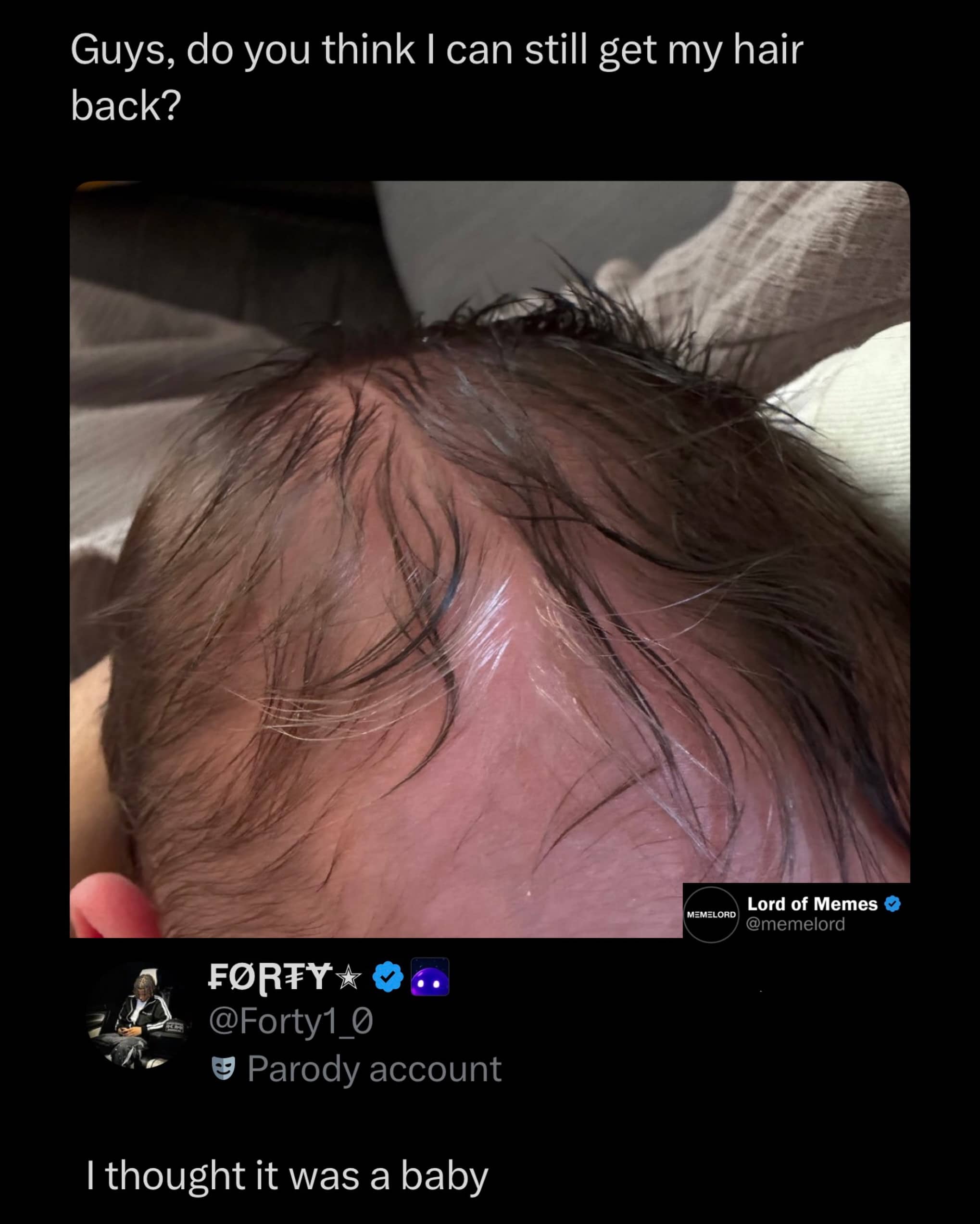 Close-up of a balding head with thin hair that looks like a newborn baby's head.