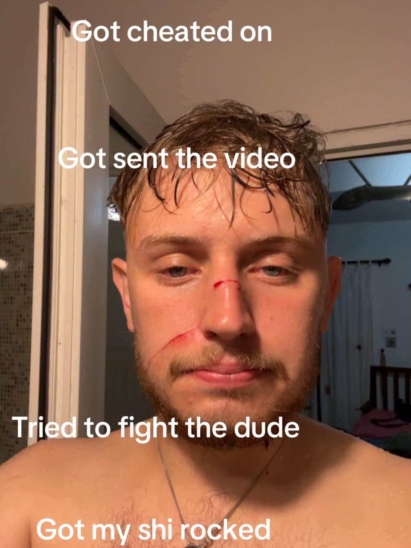 Injured young man with cuts on his nose showing a relatable bad day story template.