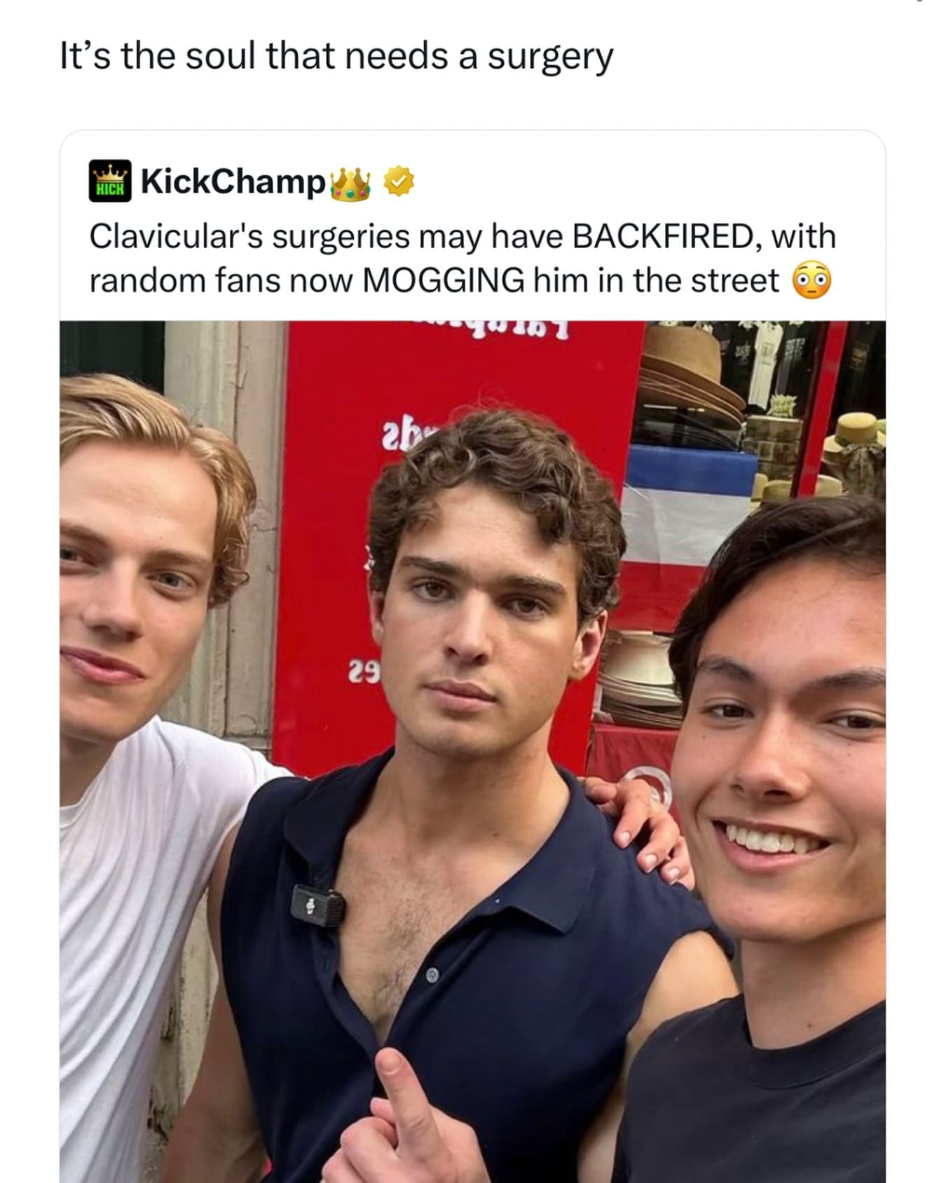 Social media post showing a streamer who had clavicle widening surgery being outperformed in appearance by fans.