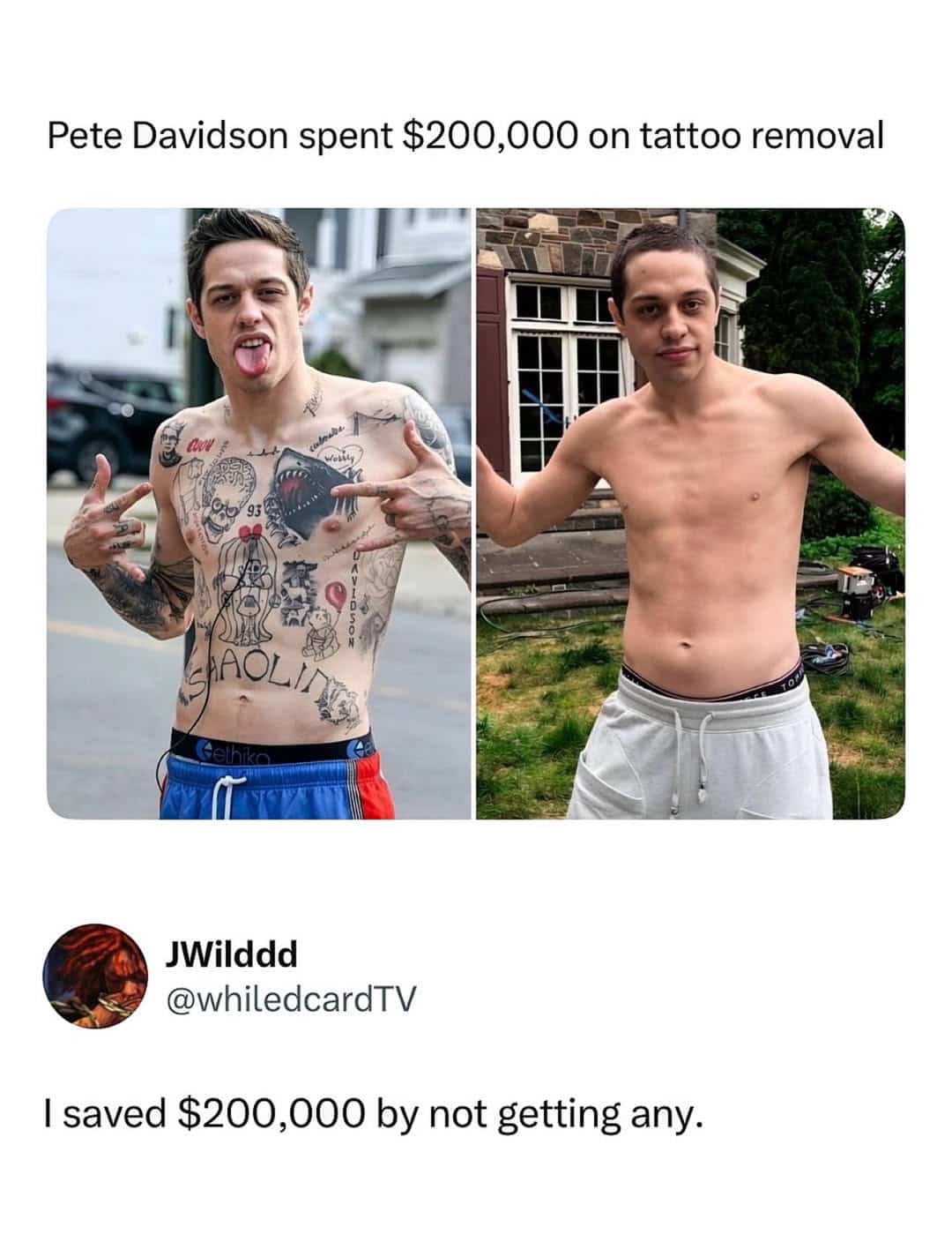 Before and after comparison meme showing Pete Davidson before and after tattoo removal treatment.