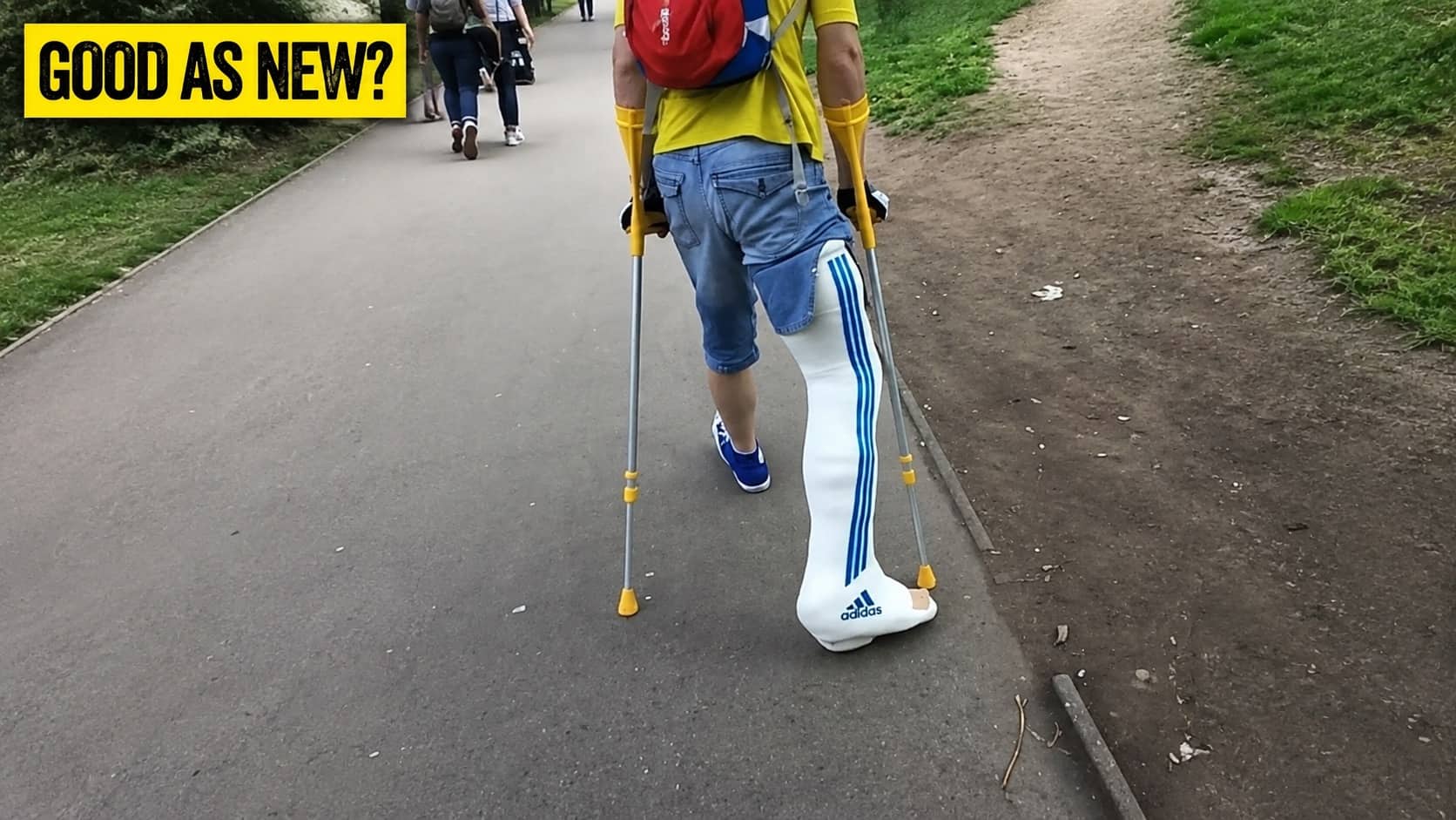 Person walking on crutches with full leg cast styled to look like Adidas track pants.