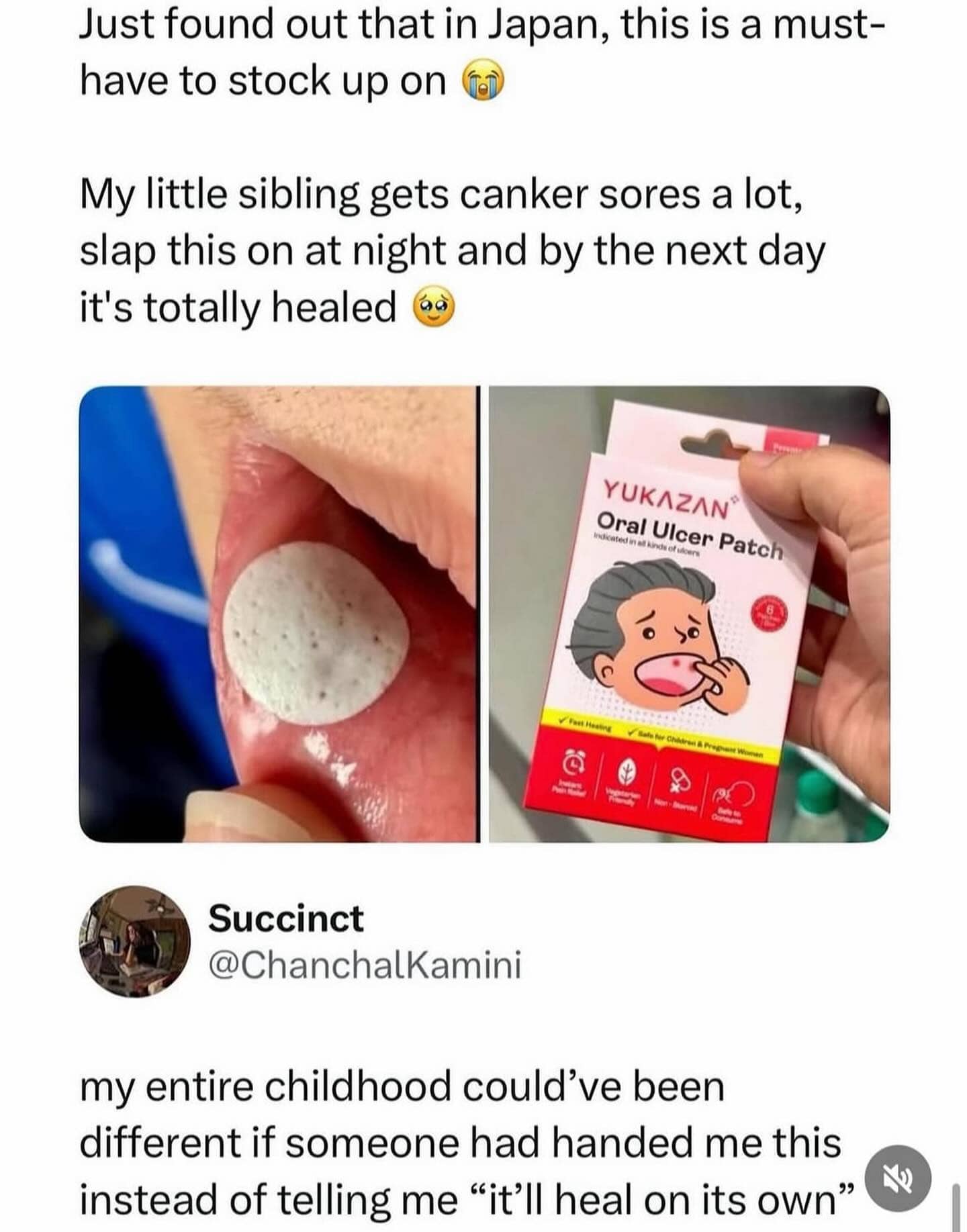 Oral ulcer patch product box next to person applying caker sore sticker on lip.