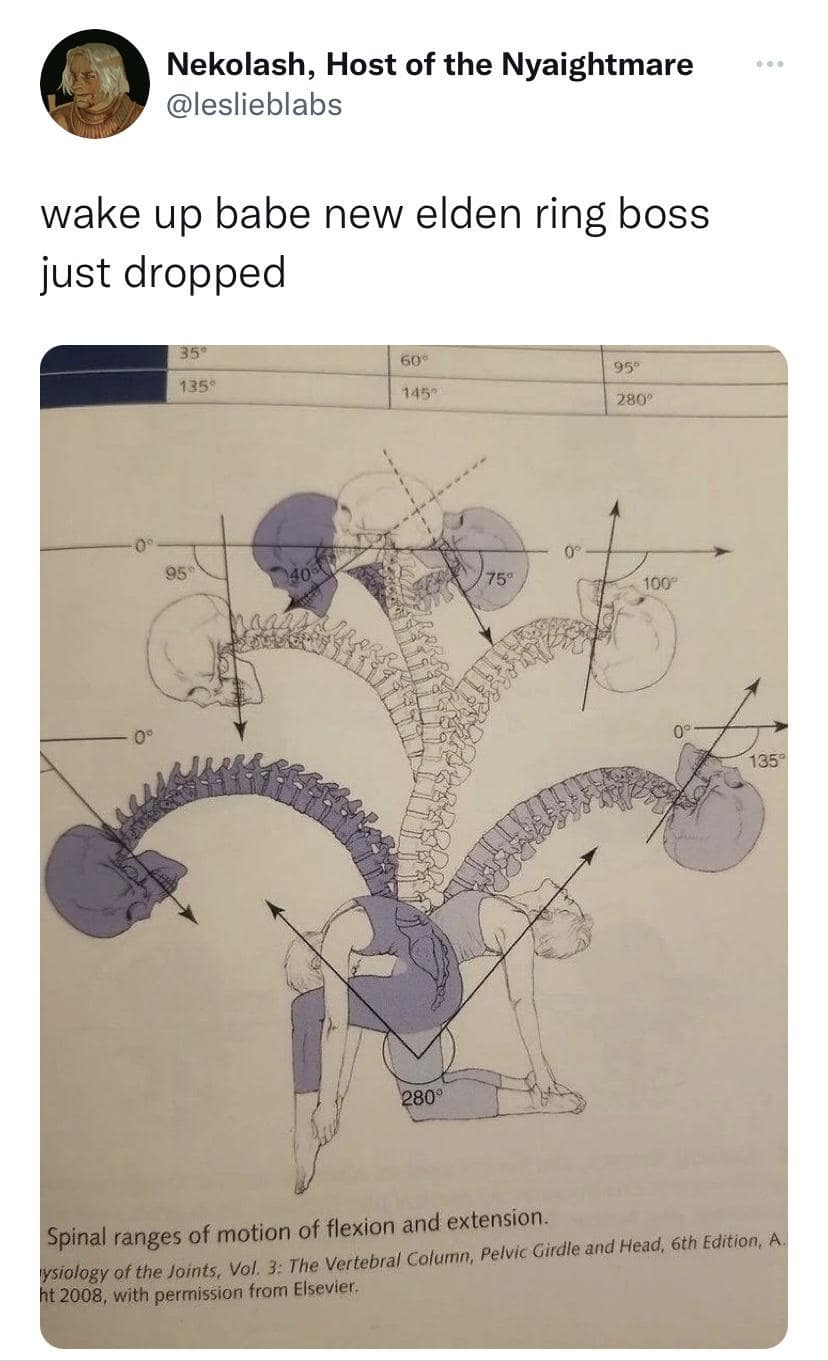 Medical textbook diagram showing extreme human spine flexibility labeled as a new Elden Ring boss reveal in a classic meme.