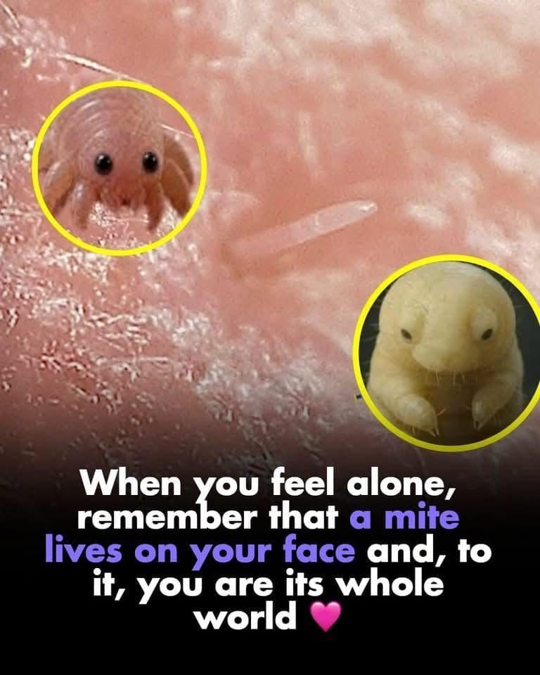 Close up of face mites with a caption saying you are their whole world.