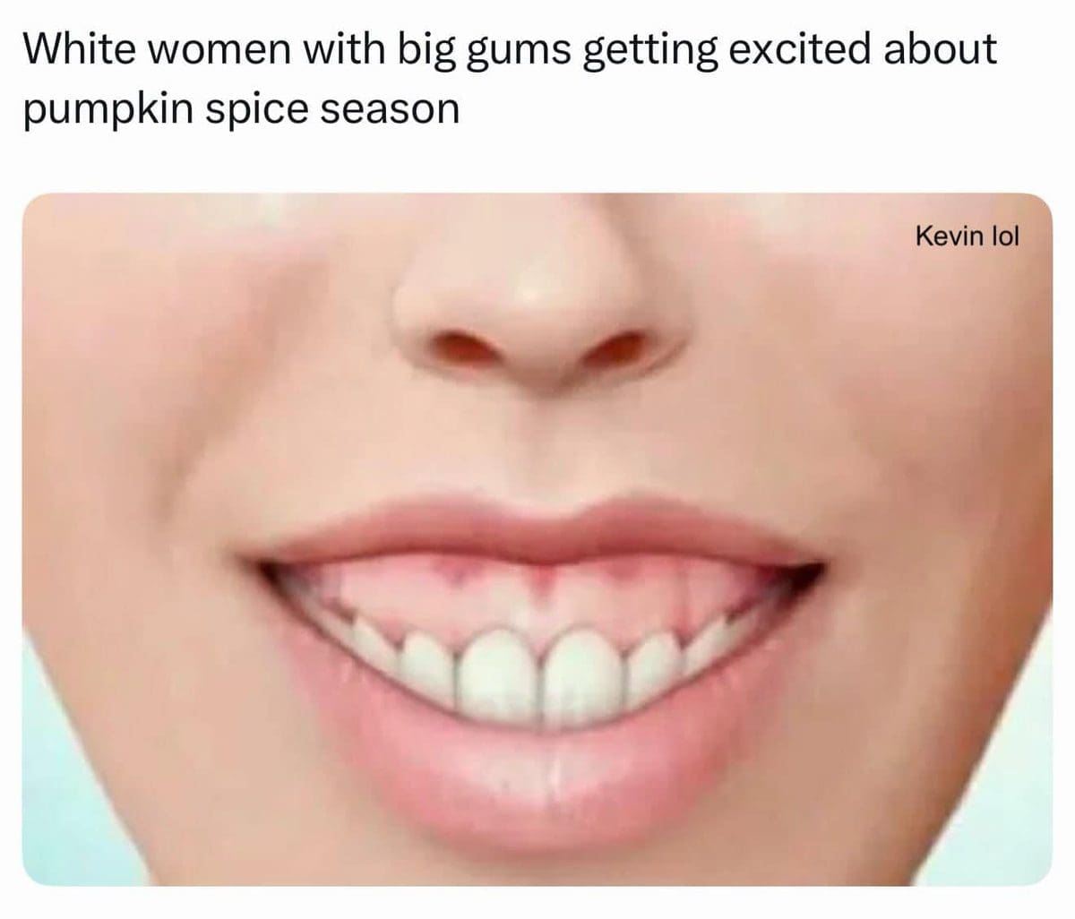Close up of a gummy smile captioned as excitement about pumpkin spice season.