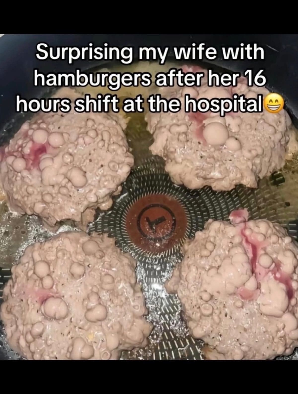 Lumpy, undercooked hamburger patties in an air fryer, captioned as a surprise dinner after a hospital shift.