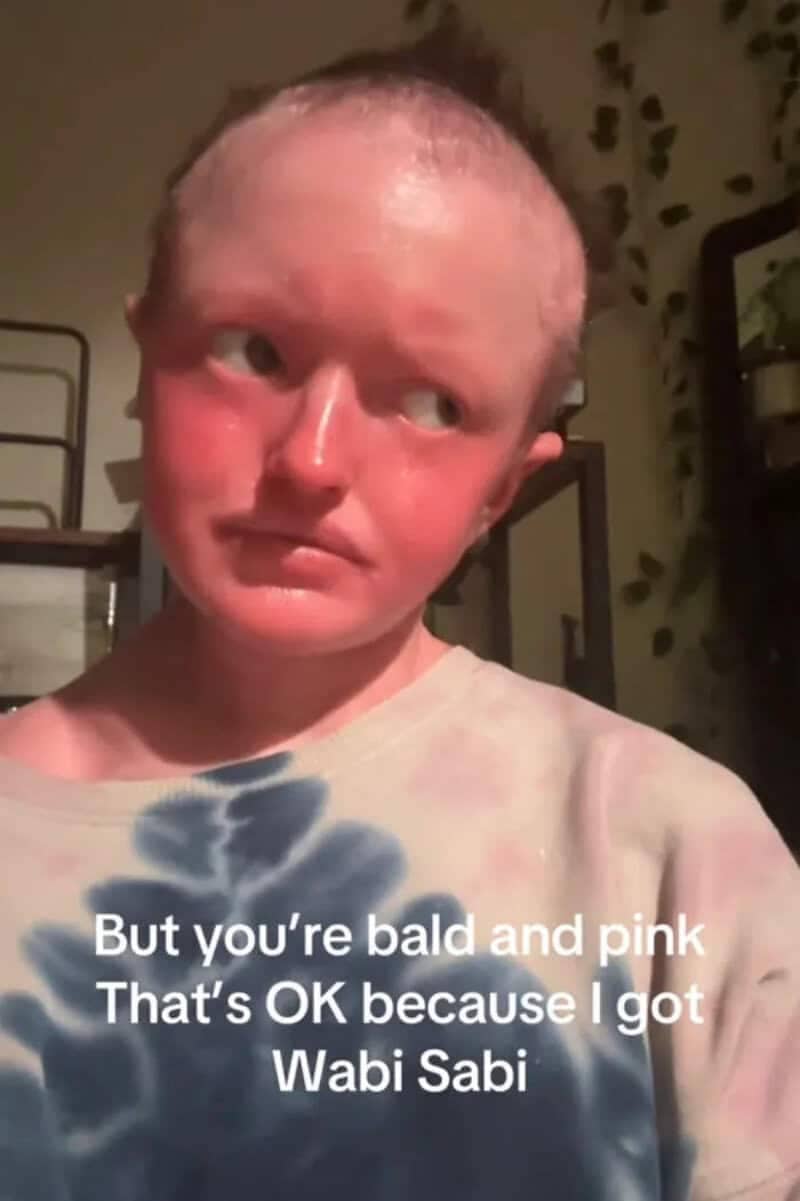 Bald individual with pink skin jokingly embracing their unique appearance as wabi sabi features.